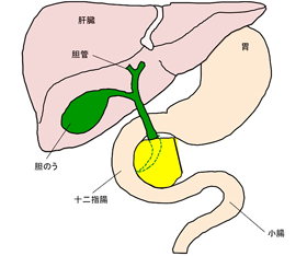 再建方法