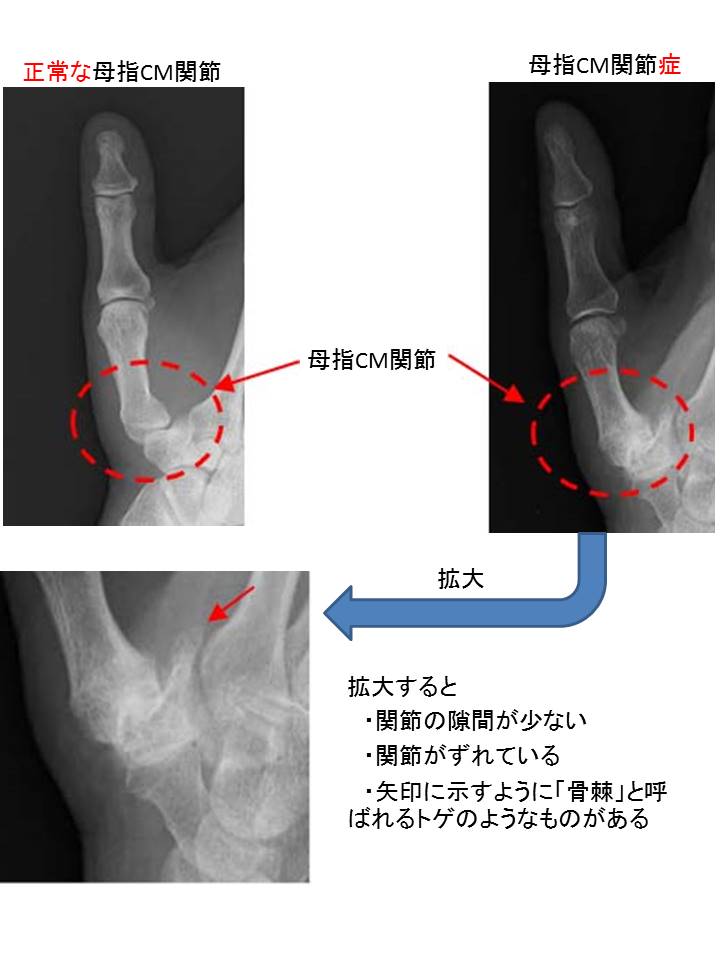 レントゲン①