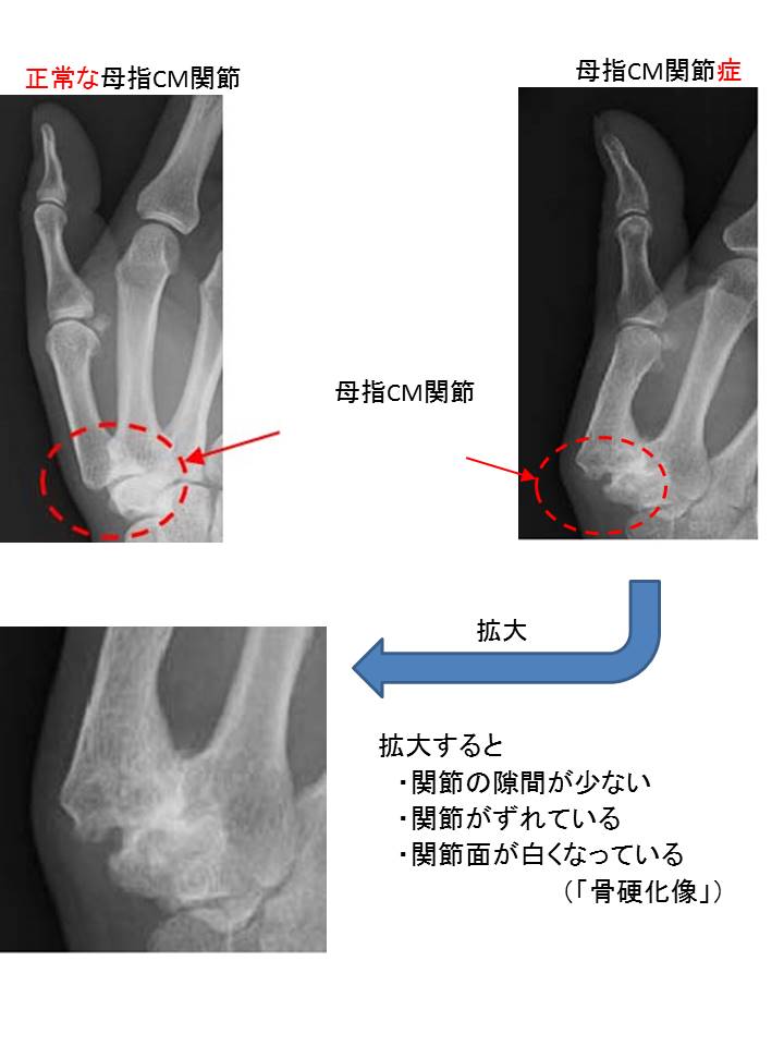 レントゲン②