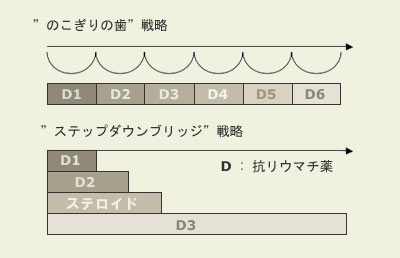 ”のこぎりの歯”戦略