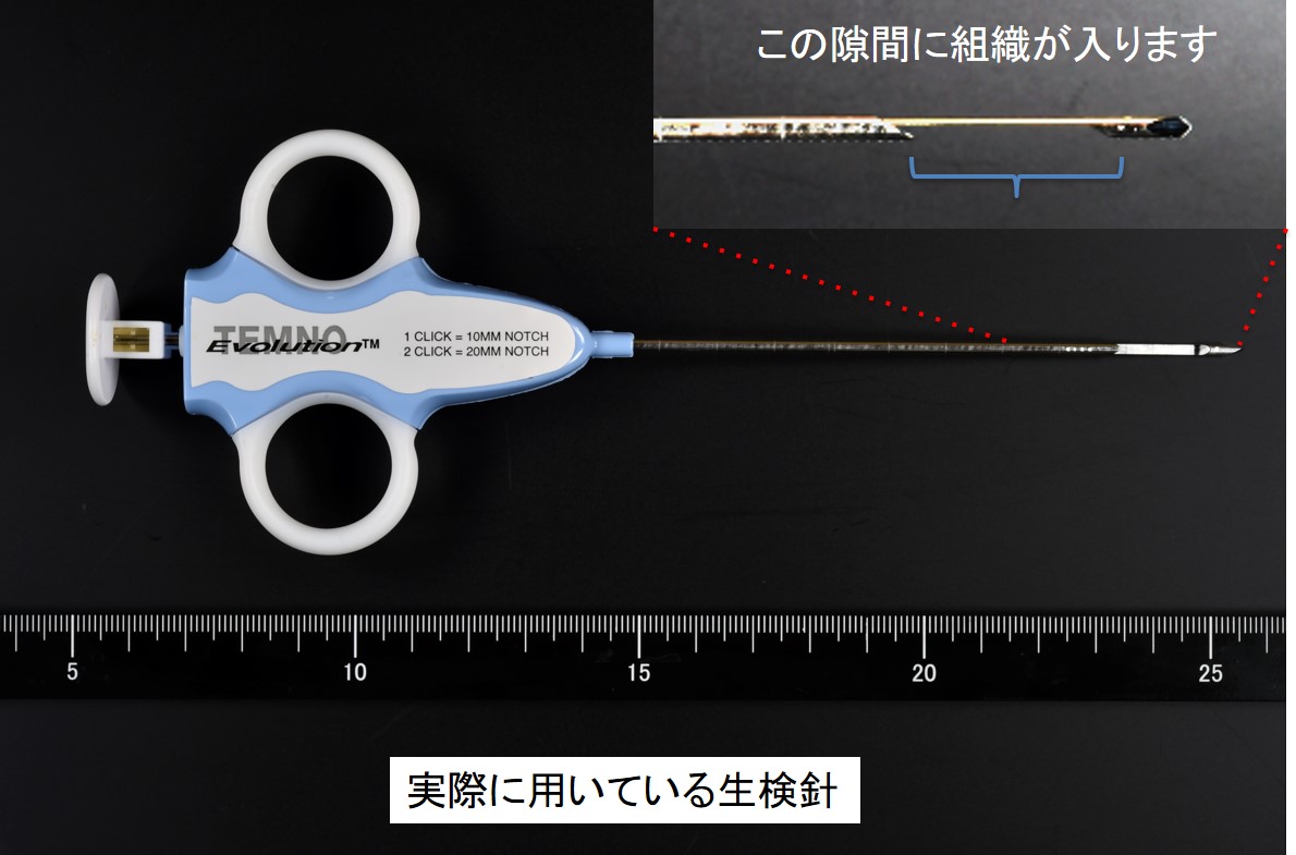 針生検①