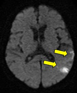 MRI②