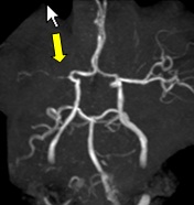 MRI③