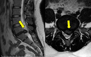 MRI④